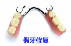 removable denture1_edited