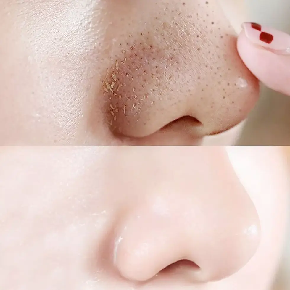 Thumbnail: 10/20/50x Blackhead Remover Nose Face Mask Strips Black Head Pore Acne Clean