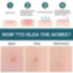 Thumbnail: Acne & Spot Patch Set | Makeup Bag | Mascara| Jewellery Box | Lip Liner