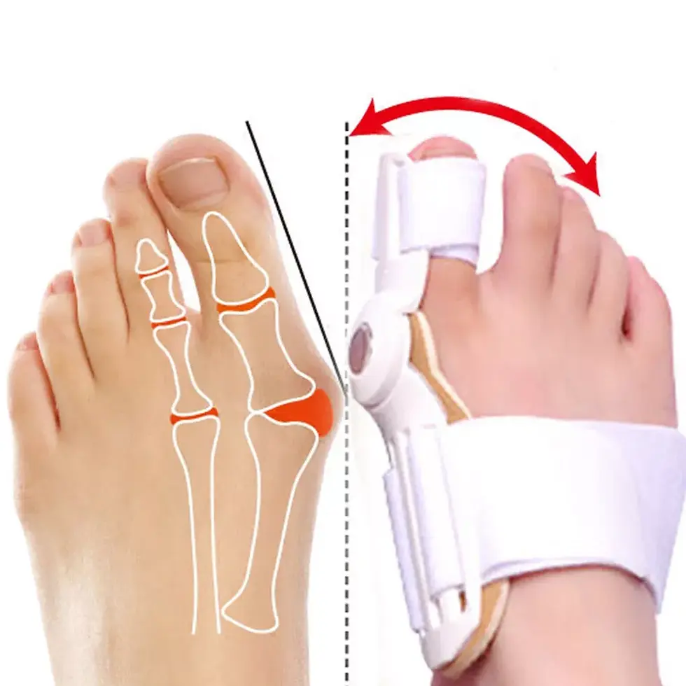 Thumbnail: Toe Bunion Corrector Orthopedic Brace Mobility Scooters | Stethoscopes