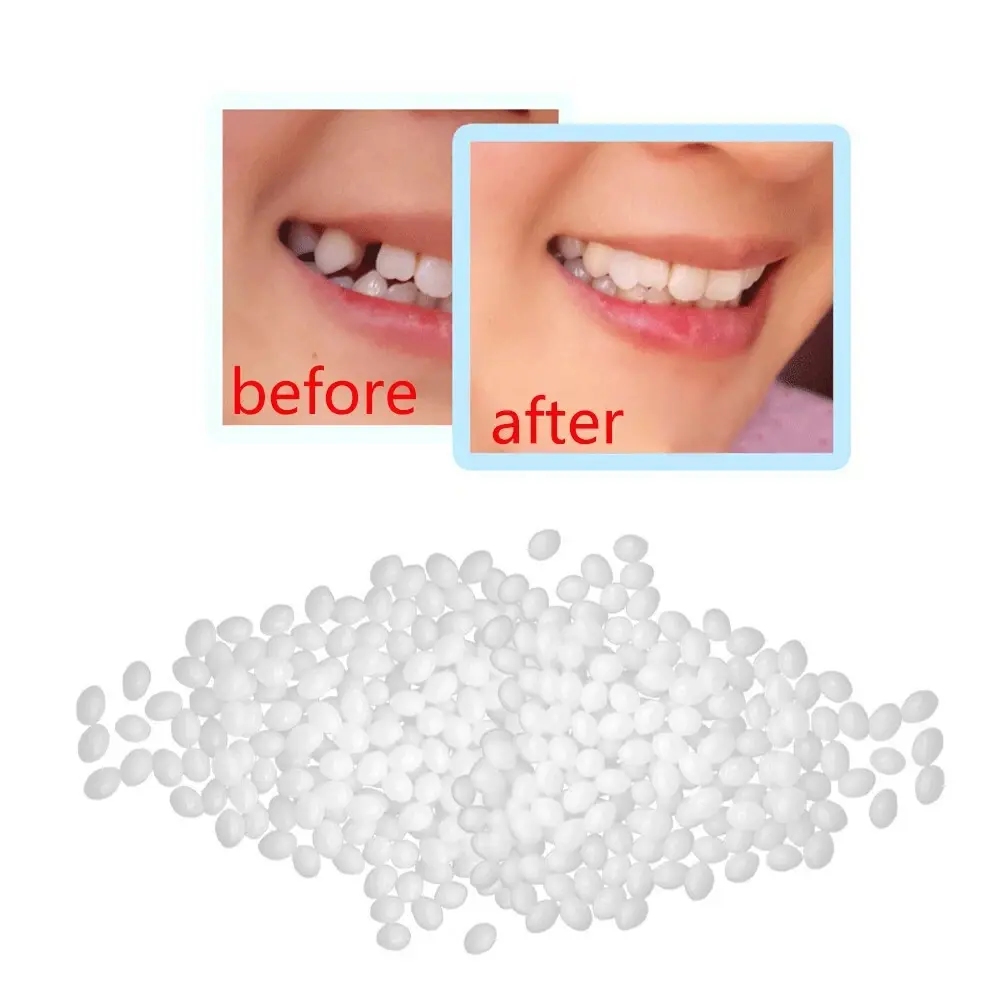 Temporary Tooth Repair Kit Glue | Mobility Scooters | Stethoscopes