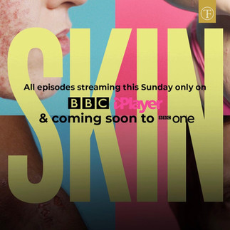 SKIN on BBC iplayer
