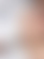 Preparing for a Special Occasion: How to Optimise Your Skin Before an Event