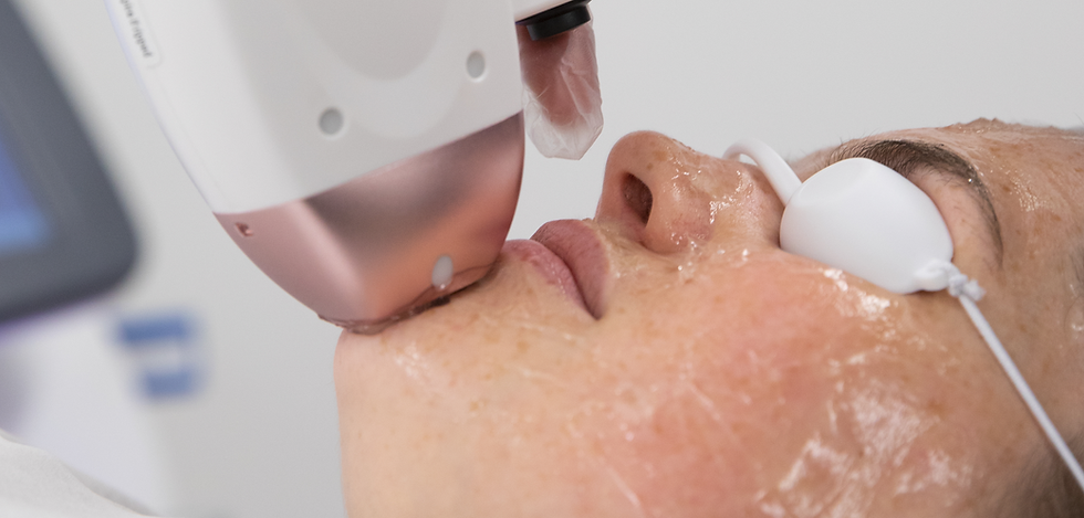 2024.05.25 House of Clio laser skin rejuvenation bournemouth.png