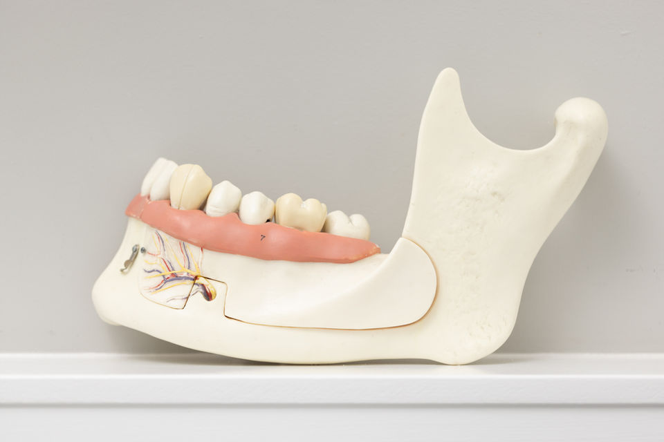 Dental Model
