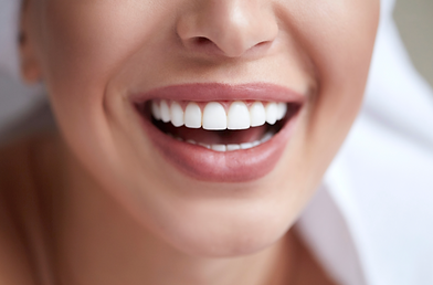 Perfect Smile