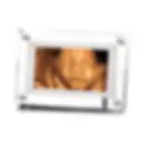 Digital Ultrasound Frame