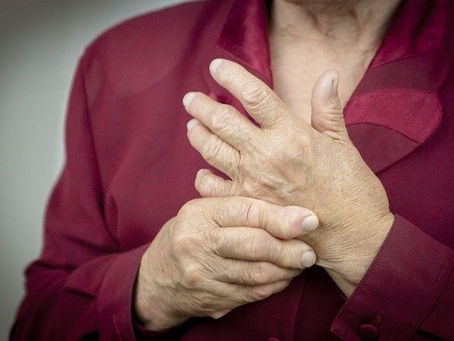 Rheumatoid Arthritis