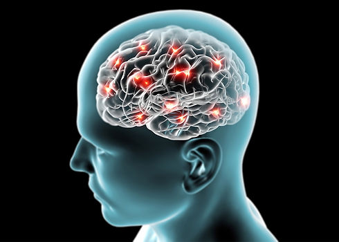 151213_FT_Brain-Zapping-Device .jpg.CROP.promo-xlarge2.jpg