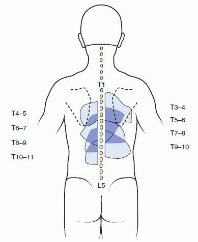 Схема боли человека. Локализация боли в спине на картинках. Справа снизу спины. Снизу спины синие полосы.