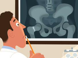 ¿Puedo hacer algo por mis huesos? 10 tips (Parte 2)