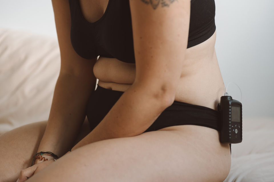 Close up of a woman's torso wearing an insulin pump, celebrating her body during an intimate portrait session