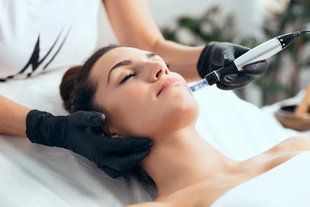 microneedling.webp