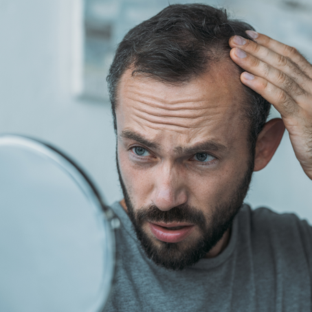 "Understanding Male Hair Thinning: Causes, Prevention, and Solutions"