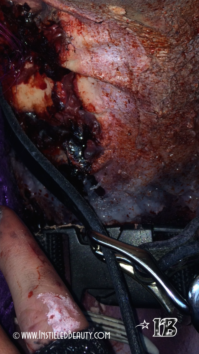 Instilled Beauty - Makeup Artistry - Wound 03.png