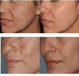 prenos - 2023-03-09T132243.340 (1).png