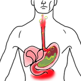 Stomach Ache