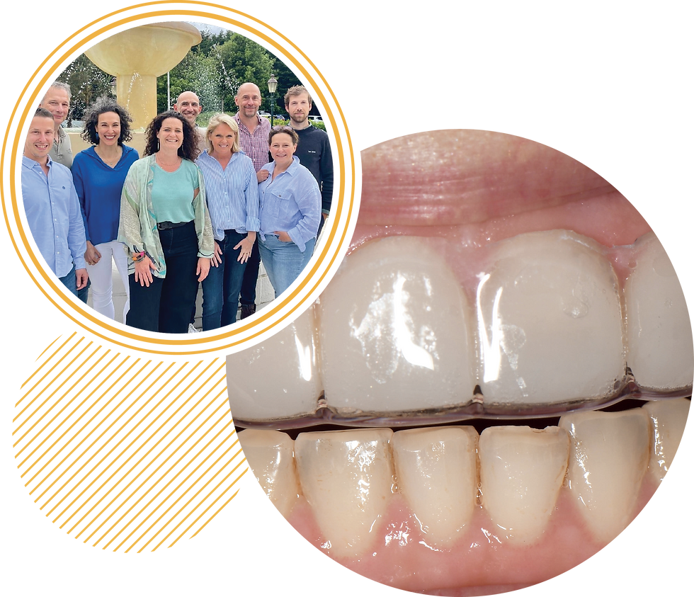 Maîtriser les gouttières occlusales