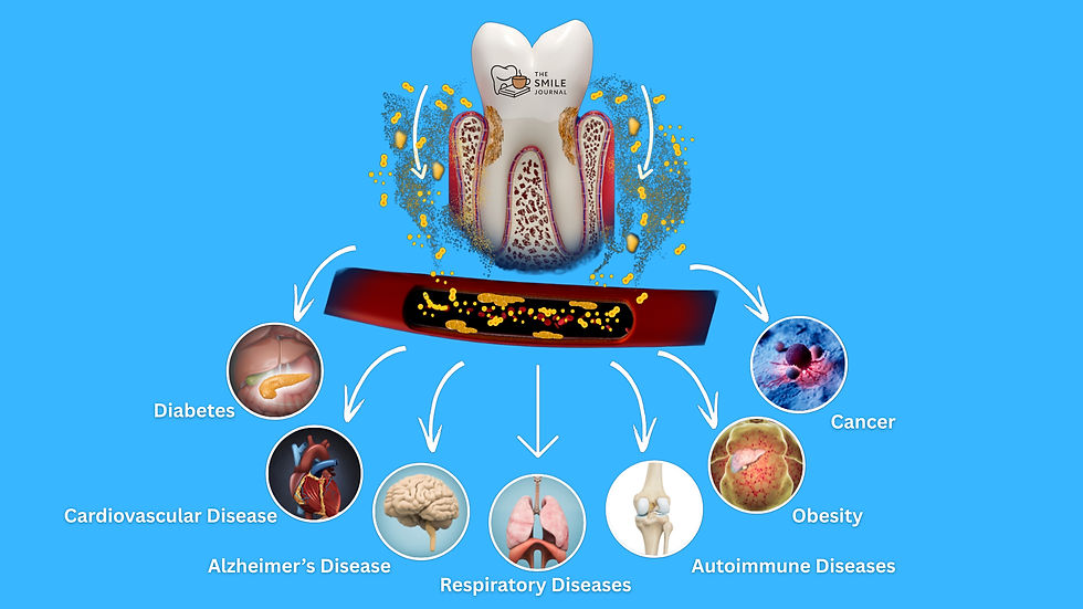 Tooth with bacteria, showing links to diseases like diabetes and cancer. Blue background, arrows connect diseases, "The Smile Journal" text. Gum Disease in Guyana