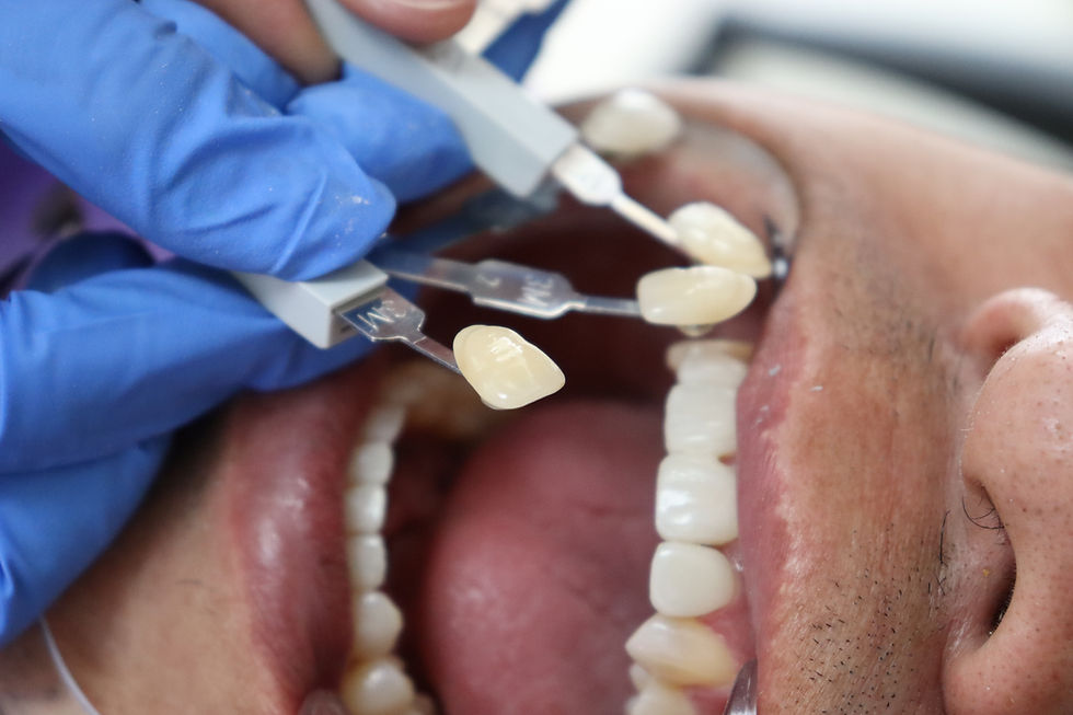 Dental Crowns