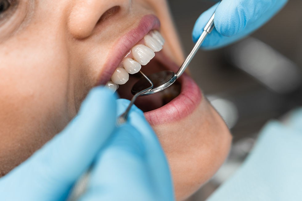 Dental Exam