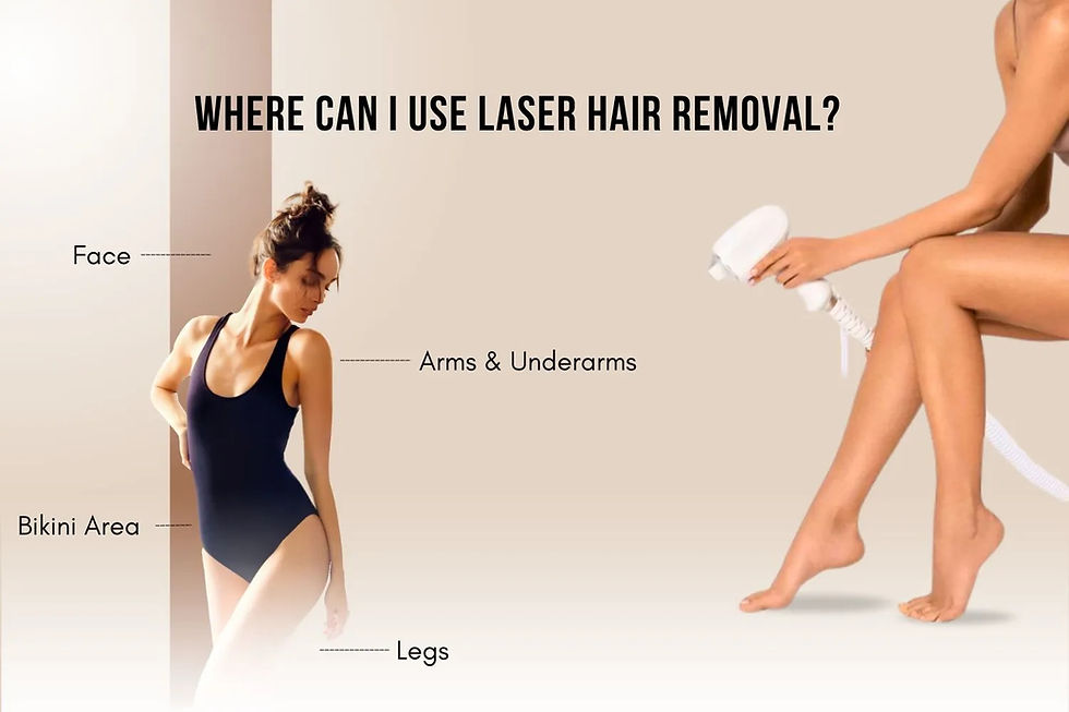laser hair removal areas: face, arms, underarms, bikini, Area legs.And full body at Nova aesthetic clinic . And More