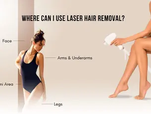 Laser Hair Removal And Expert Care at Nova Aesthetic Clinic.