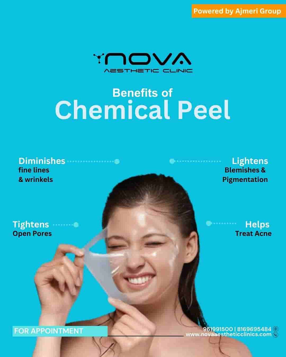 Benefits of Chemical Peel Treatment for Men, Women & Brides/Grooms—Why Makeup Is Not the Solution