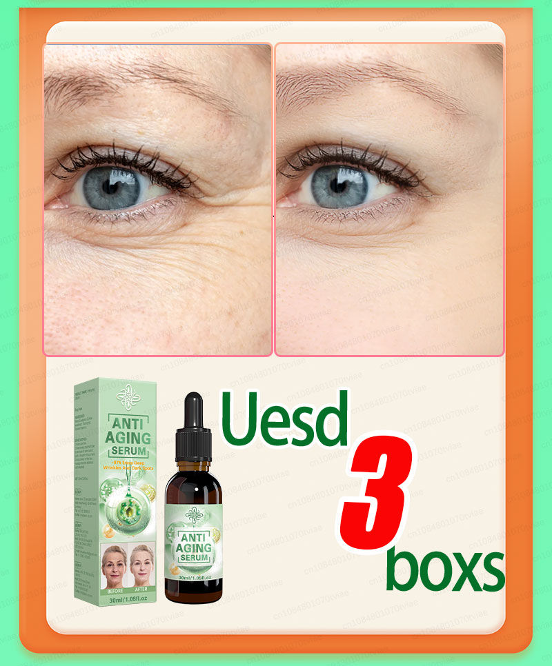 Thumbnail: Wrinkles disappear, the first choice for beauty lovers
