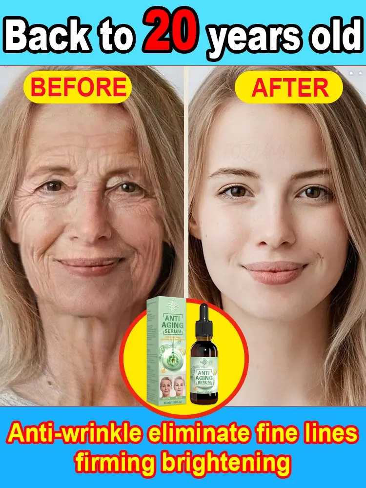 Thumbnail: Wrinkles disappear, the first choice for beauty lovers