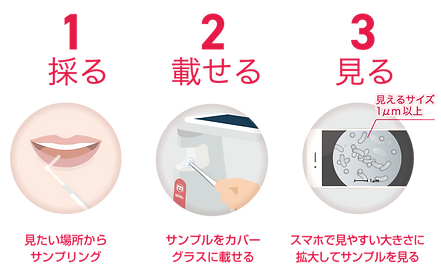 3step_ctype.png