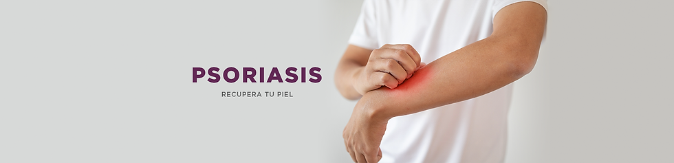 psoriasis-.png