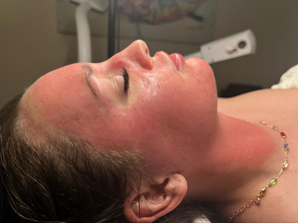 Microneedling in Amarillo, TX