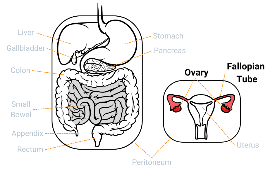 Ovaries and fallopian tubes within the abdominal (also called peritoneal) cavity.