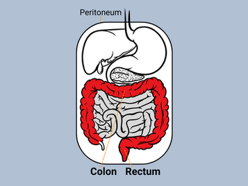 The peritoneal cavity with the colon and rectum highlighted for a study on treating colorectal cancer with immunotherapies.