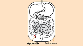Rising Awareness for a Rare Cancer: Understanding Appendix Cancer