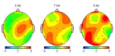 Neurofeedback North | Northbrook, IL