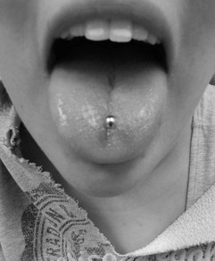 Tongue