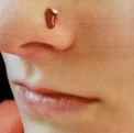 Bleeding