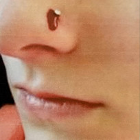 Bleeding