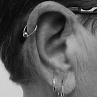 Helix $69