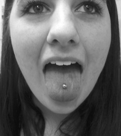 Tongue