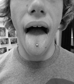 Tongue