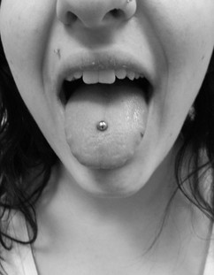 Tongue