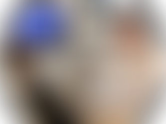 Best cosmetic advice from your Napa dentist: the quiet details patients notice that define exceptional dental care