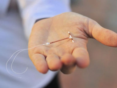 Diferença entre DIU e SIU: especialista explica - por Carla Clara