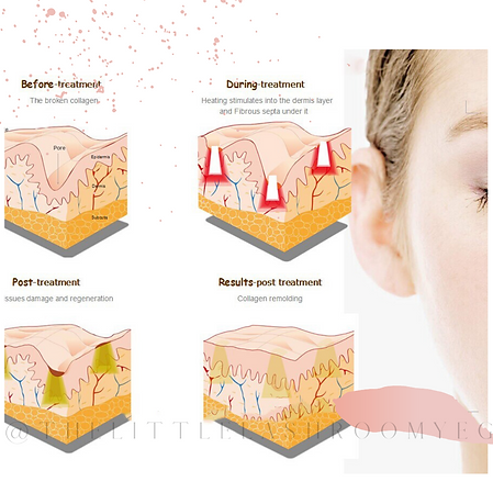 @thelittlelashroomyeg (2).png