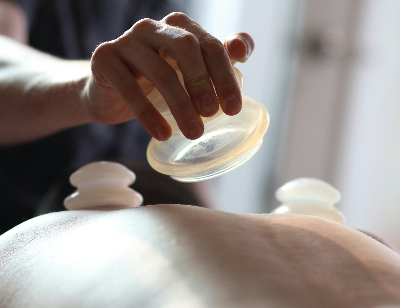 Cupping