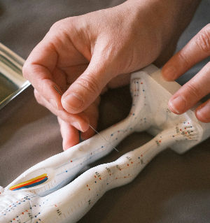 The Essential Conflict Between Acupuncture and Dry Needling: A Case of Packaged Appropriation