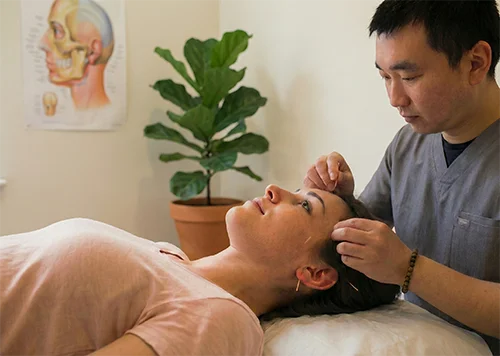 London TMJ Acupuncture